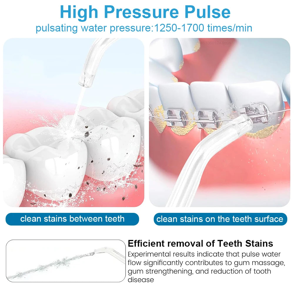 Water Flosser – High Pressure Cleaning with 800ML Capacity and Five Tips